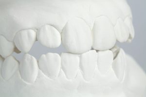 tips to stop grinding teeth
